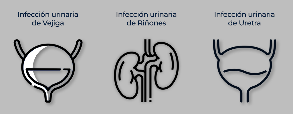 Tipos de infecciones urinarias